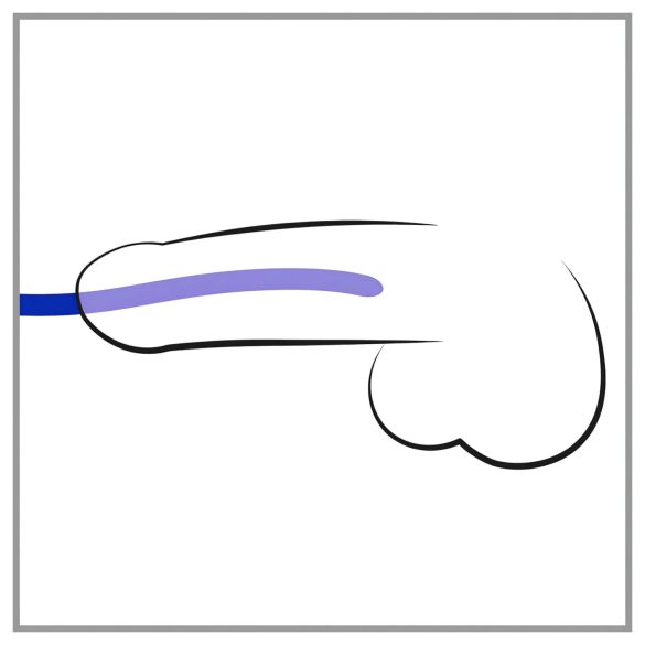 You2Toys - Silikon Dilatator Set (3 Stk.)